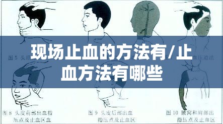 现场止血的方法有/止血方法有哪些 现场止血的方法有/止血方法有哪些