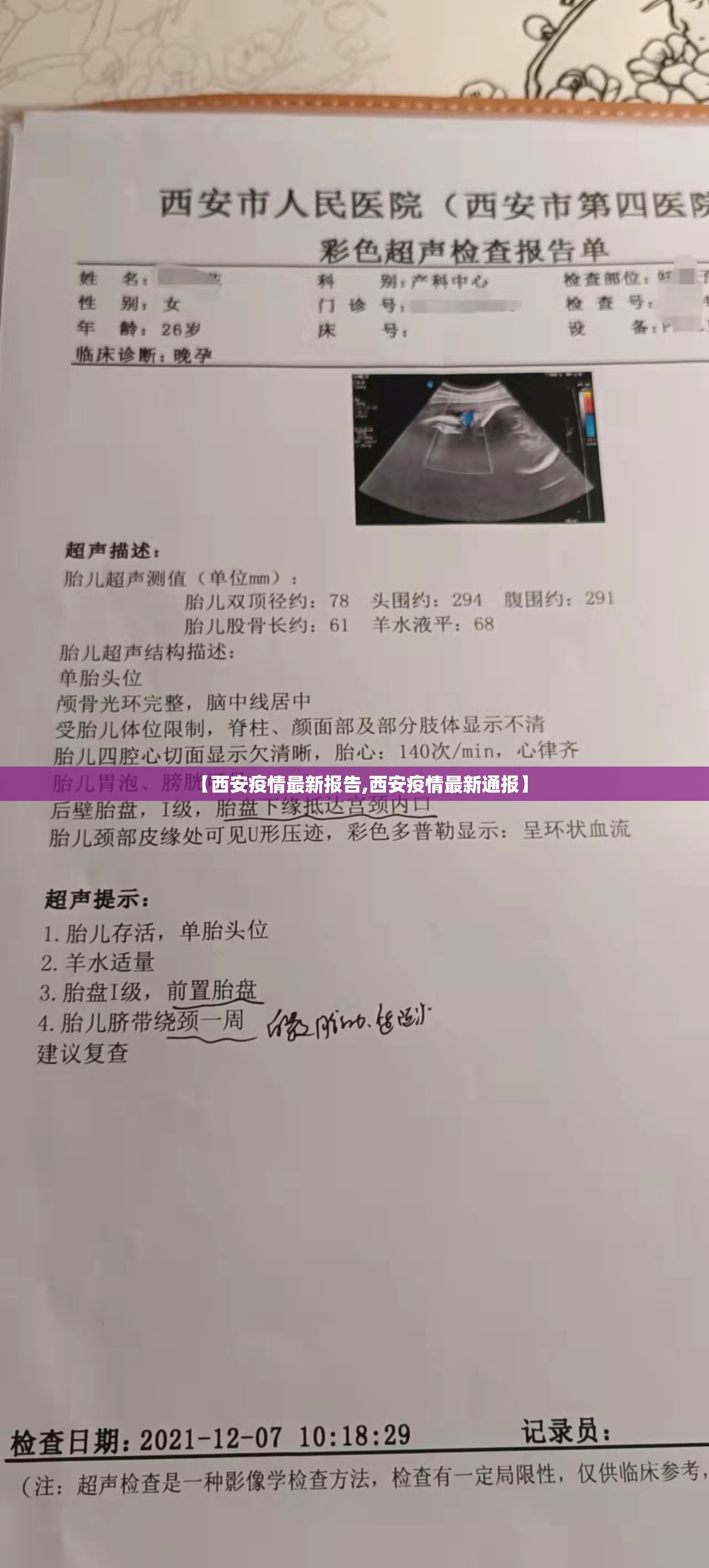 【西安疫情最新报告,西安疫情最新通报】 【西安疫情最新报告,西安疫情最新通报】